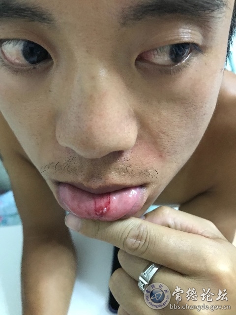 触屏版