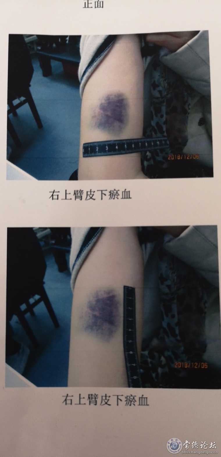 附件一5